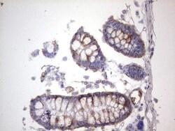 dedicator of cytokinesis 8 Antibody (OTI4H10), Novus Biologicals 0.1mL;