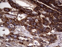 dedicator of cytokinesis 8 Antibody (OTI4H10), Novus Biologicals 0.1mL;