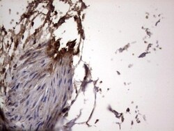 dedicator of cytokinesis 8 Antibody (OTI4H10), Novus Biologicals 0.1mL;