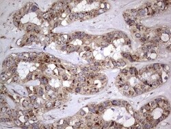 dedicator of cytokinesis 8 Antibody (OTI4H10), Novus Biologicals 0.1mL;