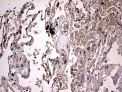 dedicator of cytokinesis 8 Antibody (OTI4H10), Novus Biologicals 0.1mL;