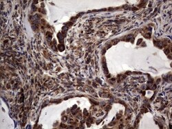 dedicator of cytokinesis 8 Antibody (OTI4H10), Novus Biologicals 0.1mL;