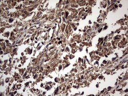 dedicator of cytokinesis 8 Antibody (OTI4H10), Novus Biologicals 0.1mL;