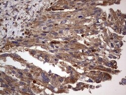 dedicator of cytokinesis 8 Antibody (OTI4H10), Novus Biologicals 0.1mL;