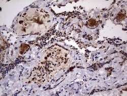 dedicator of cytokinesis 8 Antibody (OTI4H10), Novus Biologicals 0.1mL;