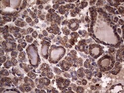 dedicator of cytokinesis 8 Antibody (OTI4H10), Novus Biologicals 0.1mL;