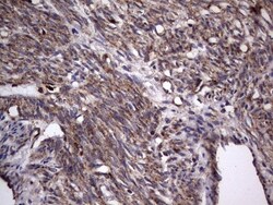 dedicator of cytokinesis 8 Antibody (OTI4H10), Novus Biologicals 0.1mL;