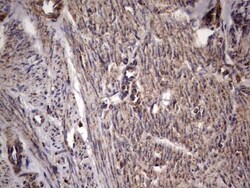 dedicator of cytokinesis 8 Antibody (OTI4H10), Novus Biologicals 0.1mL;
