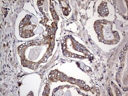 dedicator of cytokinesis 8 Antibody (OTI4H10), Novus Biologicals 0.1mL;