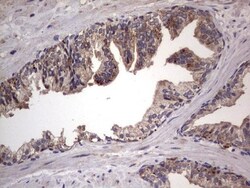 dedicator of cytokinesis 8 Antibody (OTI4H10), Novus Biologicals 0.1mL;