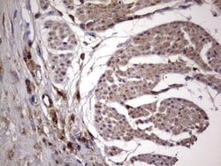 dedicator of cytokinesis 8 Antibody (OTI4H10), Novus Biologicals 0.1mL;