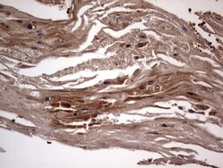 dedicator of cytokinesis 8 Antibody (OTI4H10), Novus Biologicals 0.1mL;