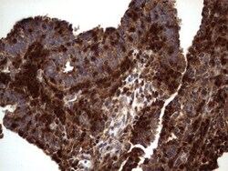 dedicator of cytokinesis 8 Antibody (OTI4H10), Novus Biologicals 0.1mL;