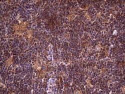 dedicator of cytokinesis 8 Antibody (OTI4H10), Novus Biologicals 0.1mL;