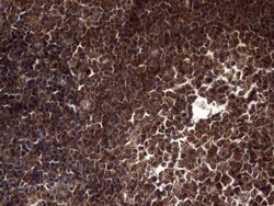 dedicator of cytokinesis 8 Antibody (OTI4H10), Novus Biologicals 0.1mL;