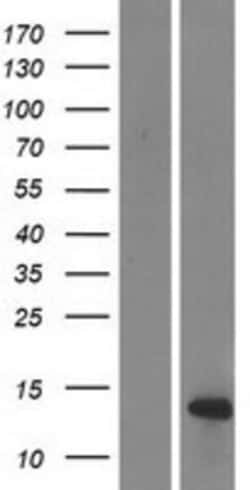 Novus Biologicals&trade;&nbsp;DEFB108B Overexpression Lysate