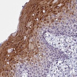 DEFB108B Antibody, Novus Biologicals:Antibodies:Primary Antibodies