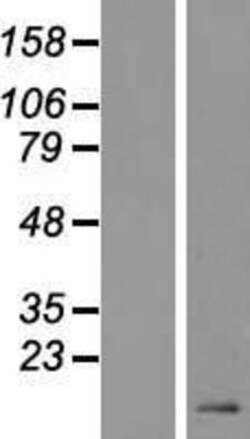 Novus Biologicals&trade;&nbsp;DEFB119 Overexpression Lysate