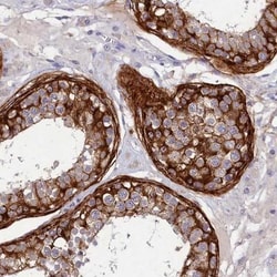 DEFB119 Antibody, Novus Biologicals:Antibodies:Primary Antibodies
