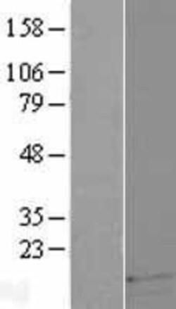 Novus Biologicals&trade;&nbsp;DEFB121 Overexpression Lysate