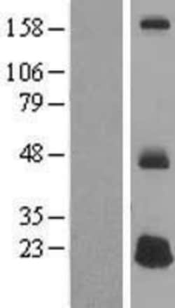 Novus Biologicals™ DEFB125 Overexpression Lysate