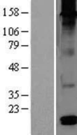 Novus Biologicals&trade;&nbsp;DEFB126 Overexpression Lysate