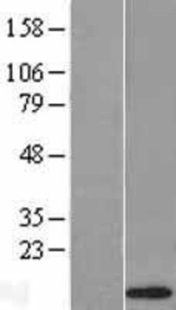 Novus Biologicals&trade;&nbsp;alpha-Defensin 1 Overexpression Lysate