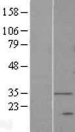 Novus Biologicals&trade;&nbsp;DEGS1 Overexpression Lysate