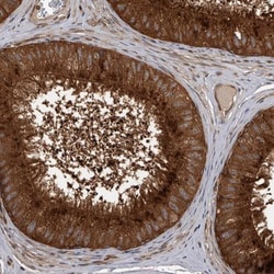 Dehydrodolichyl Diphosphate Synthase Antibody, Novus Biologicals:Antibodies:Primary