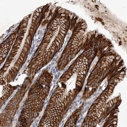 Dehydrodolichyl Diphosphate Synthase Antibody, Novus Biologicals 25 &mu;L;