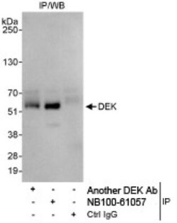 DEK Antibody, Novus Biologicals 0.1mg; Unlabeled:Antibodies, Polyclonal