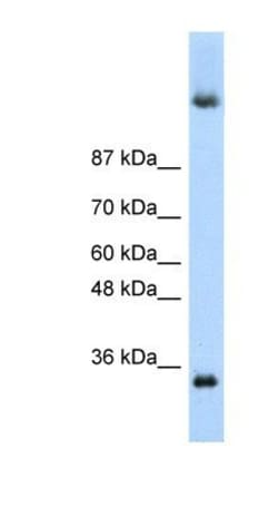 Deleted in azoospermia 4 Antibody, Novus Biologicals:Antibodies:Primary