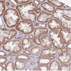 Deleted In Lymphocytic Leukemia, 7 Antibody, Novus Biologicals:Antibodies:Primary