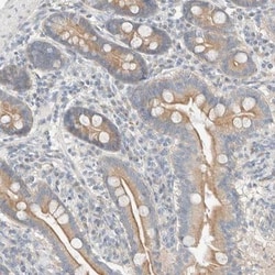 Delta 1 Tubulin Antibody, Novus Biologicals:Antibodies:Primary Antibodies