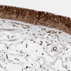 Delta 1 Tubulin Antibody, Novus Biologicals 25 &mu;L | Buy Online | Novus Biologicals | Fisher Scientific