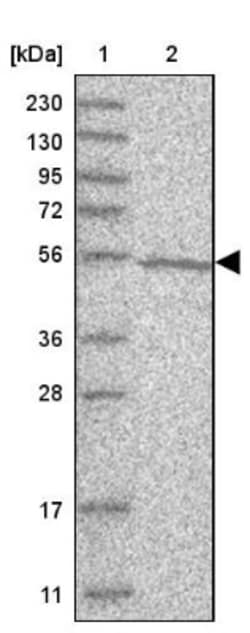 Delta 1 Tubulin Antibody, Novus Biologicals 25 &mu;L | Buy Online | Novus Biologicals | Fisher Scientific