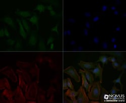 Delta Np73 Antibody (38C674.2), Novus Biologicals 0.1mg; Unlabeled:Antibodies,