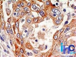 Delta Np73 Antibody (38C674.2), Novus Biologicals 0.1mg; Unlabeled:Antibodies,