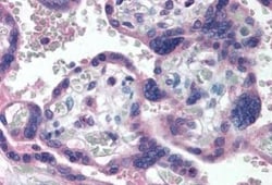 Delta Np73 Antibody (38C674.2), Novus Biologicals 0.1mg; Unlabeled:Antibodies,
