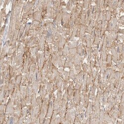 delta-Sarcoglycan Antibody, Novus Biologicals:Antibodies:Primary Antibodies
