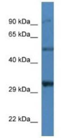 delta-Sarcoglycan Antibody, Novus Biologicals 100&mu;L; Unlabeled:Antibodies,