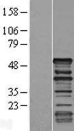 Novus Biologicals&trade;&nbsp;Dematin Overexpression Lysate