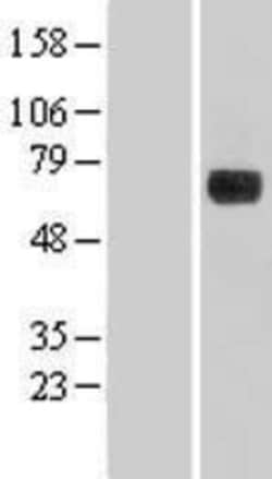 Novus Biologicals&trade;&nbsp;DENND1A Overexpression Lysate