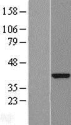 Novus Biologicals&trade;&nbsp;DENND1B Overexpression Lysate