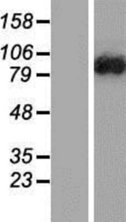 Novus Biologicals™ DENND1C Overexpression Lysate