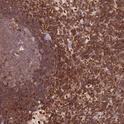DENND1C Antibody, Novus Biologicals:Antibodies:Primary Antibodies