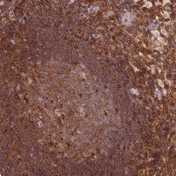 DENND1C Antibody, Novus Biologicals:Antibodies:Primary Antibodies