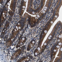 DENND4C Antibody, Novus Biologicals 25 &mu;L; Unlabeled:Antibodies, Polyclonal