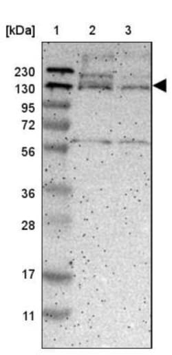 DENND4C Antibody, Novus Biologicals 25 &mu;L; Unlabeled:Antibodies, Polyclonal