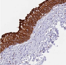 DENN/MADD Domain Containing 2D Antibody, Novus Biologicals 0.1mL; Unlabeled:Antibodies,